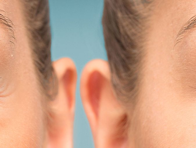 How_to_avoid_bags_under_eyes_row_1