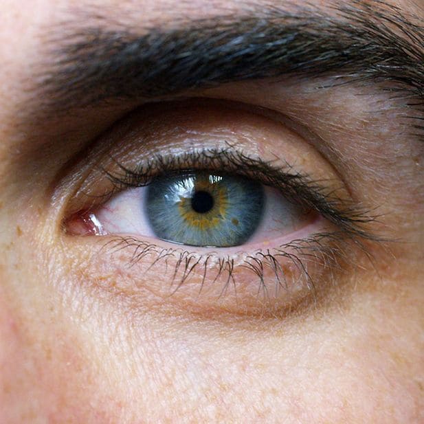 The_Side_Effects_of_Roaccutane_on_Your_Eyes_row_5