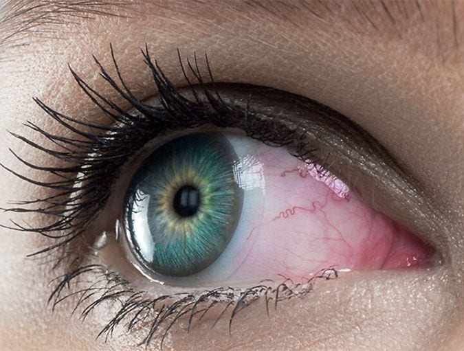 Contact_lenses_and_red_eyes_row_1